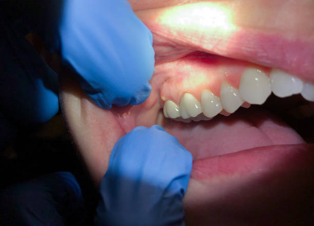 Best Pediatric Emergency Dentist in Maxwell, CA