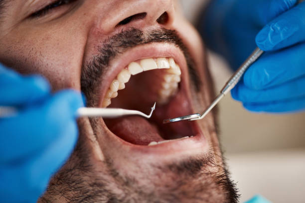 Best Walk-In Emergency Dentist in Maxwell, CA